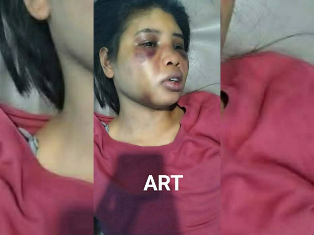 ART di Batam Disiksa 